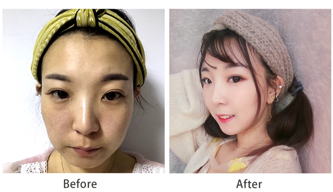 胶原蛋白肽品牌推荐，公认好用的胶原蛋白肽品牌