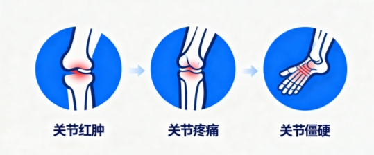 世界关节炎日|关节疼痛难忍?骨痛灵酊快速缓解,对抗关节炎症