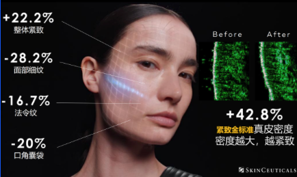 2026抗老面霜精选：修丽可AGE面霜，破解 “越补越老” 的全链路抗糖方案