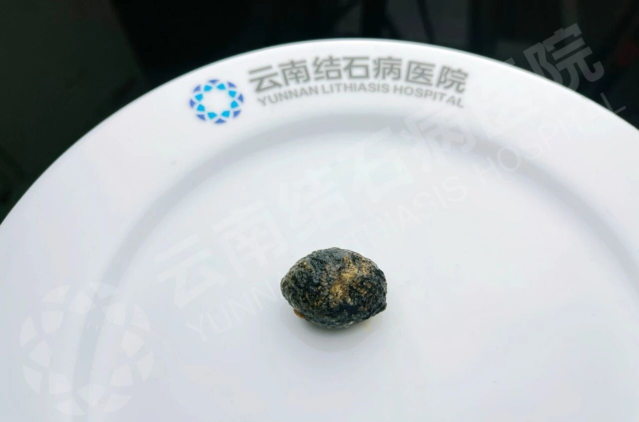 a2a42138ly1iceiy94vruj20zk0nh75c.jpg
