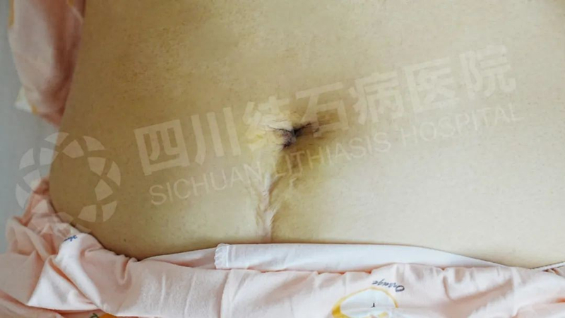 f5d3162e2f544936bf4dfb1784c570b2_tplv-tt-origin-web_gif_副本.jpg