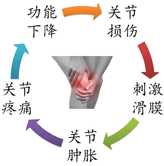 罹患骨关节炎该如何应对？氨基葡萄糖就是可靠帮手