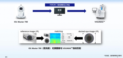 全国首批！济南普瑞眼科落地全飞秒SMILE pro散光矫正增强版，技术迭代再升级!